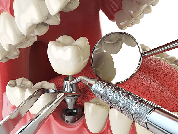 Best Emergency Tooth Extraction in Conneaut Lakeshore, PA